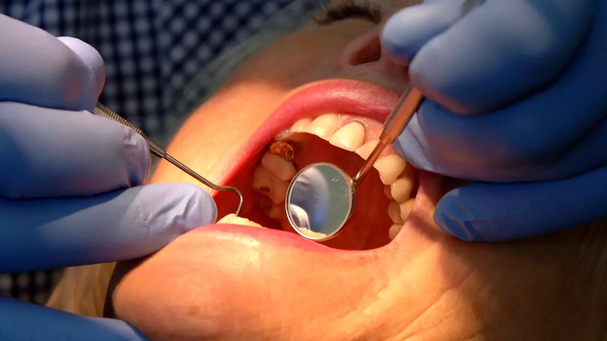 nottingham universitesinden dis minesini onaran yeni jel qdrAhgFc.jpg